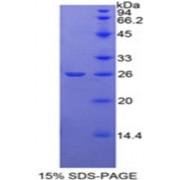 Rat Protein O-GlcNAcase / MGEA5 (OGA) Protein
