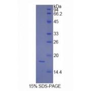 Human Platelet Derived Growth Factor C (PDGFC) Protein