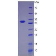 Human Programmed Cell Death 1 Ligand 1 (CD274) Protein