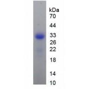 Mouse Receptor Activator Of Nuclear Factor Kappa B (RANk) Protein