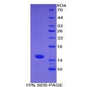 Mouse S100 Calcium Binding Protein A7 (S100A7) Protein