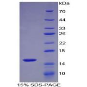 Mouse Protein S100-A9 / CAGB (S100A9) Protein