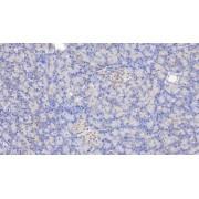 Coagulation Factor III, Tissue Factor / CD142 (F3) Antibody