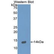 Neuregulin 2 (NRG2) Antibody