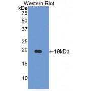 Interleukin 17B (IL17B) Antibody