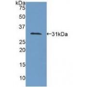 Collagen Type IV Alpha 1 (COL4A1) Antibody