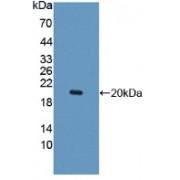 Interleukin 10 Receptor Beta (IL10Rb) Antibody