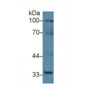 Receptor Activator of Nuclear Factor Kappa B (RANk) Antibody