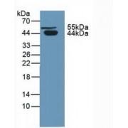 Protein C Inhibitor (SERPINA5) Antibody