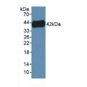 Platelet Factor 4 Variant 1 (PF4V1) Antibody