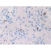 Macrophage Inflammatory Protein 4 Alpha (MIP4a) Antibody