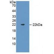 FMS Like Tyrosine Kinase 3 Ligand (Flt3L) Antibody