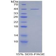 Human Platelet Factor 4 Variant 1 (PF4V1) Protein