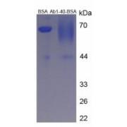 Mouse Amyloid Beta Peptide 1-40 (Ab1-40) Peptide (BSA)