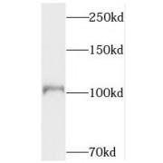 DNA Topoisomerase 3-Alpha (TOP3A) Antibody