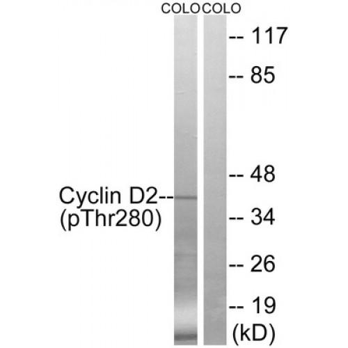 G1/S-Specific Cyclin-D2 Phospho-Thr280 (CCND2 pT280) Antibody