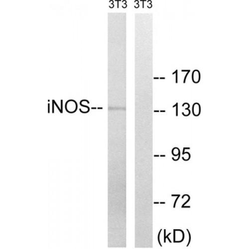 Nitric Oxide Synthase, Inducible (NOS2) Antibody