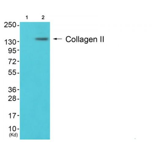 Collagen Type II (COL2) Antibody
