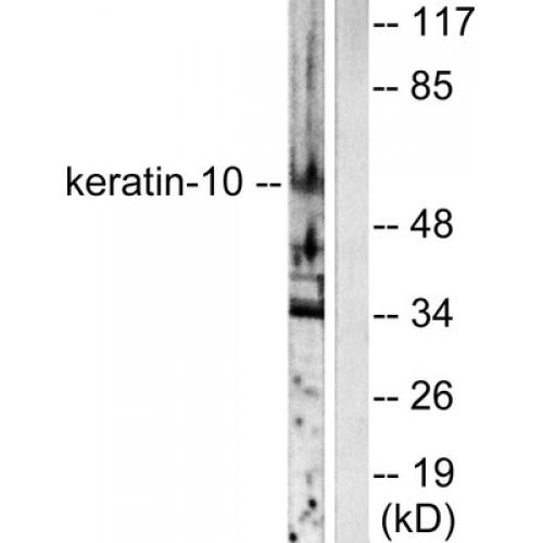 Keratin 10 (KRT10) Antibody