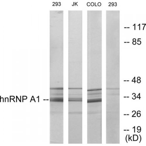 Heterogeneous Nuclear Ribonucleoprotein A1 (hnRNP A1) Antibody