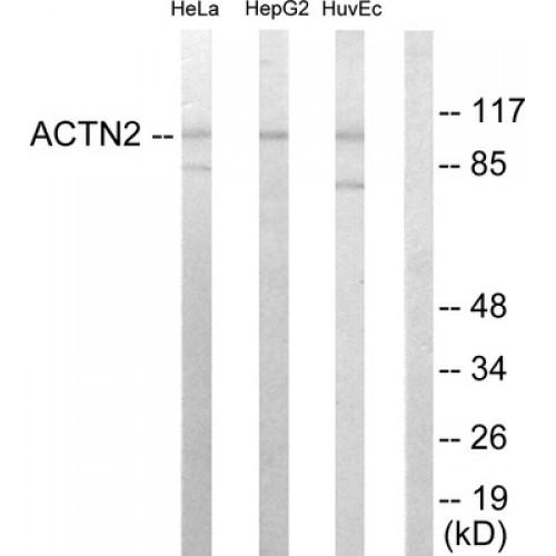 Actinin alpha 2 / 3 Antibody