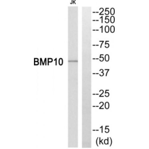 Bone Morphogenetic Protein 10 (BMP10) Antibody