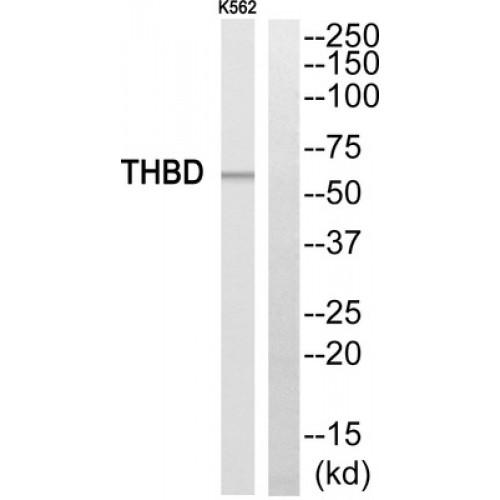 Thrombomodulin (THBD) Antibody