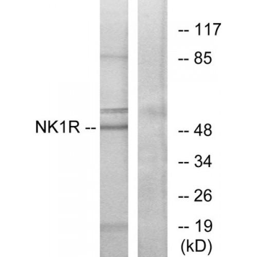 Tachykinin Receptor 1 (TACR1) Antibody