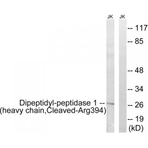 Cathepsin C (CTSC) Antibody
