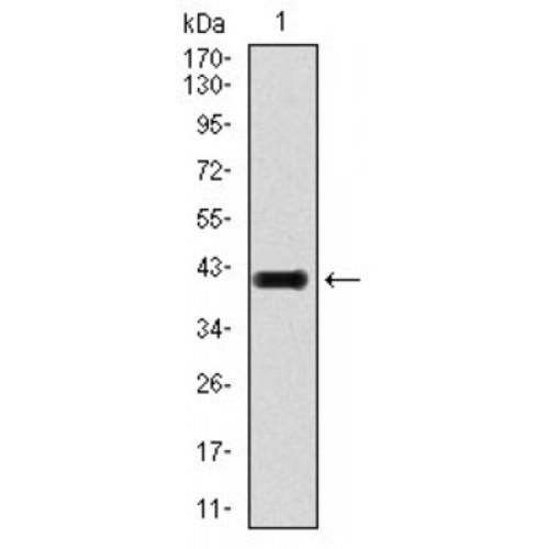 Transforming Growth Factor Beta 1 (TGFb1) Antibody