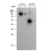 SARS-CoV-2 Spike Protein RBD Antibody