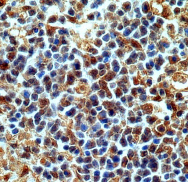 anti- Caspase 3 antibody