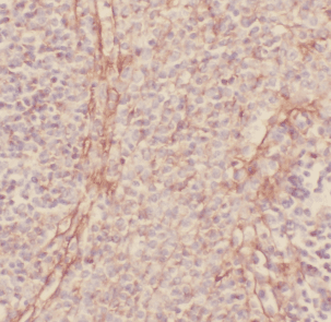 anti- CD33 antibody